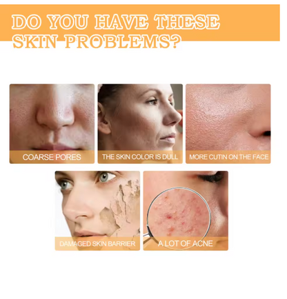 Eelhoe - Glycolic Acid 7% Toning Solution